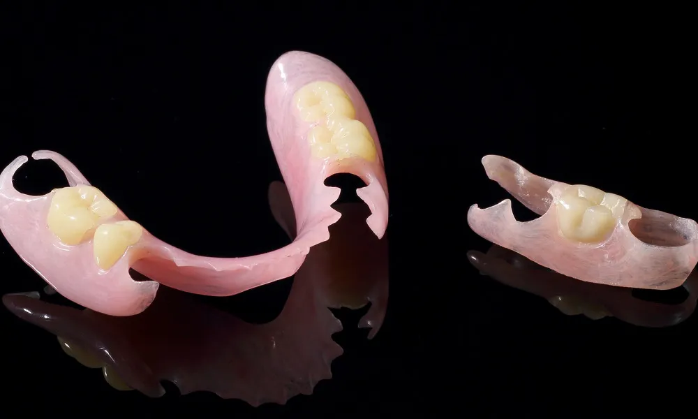 ノンクラスプデンチャー