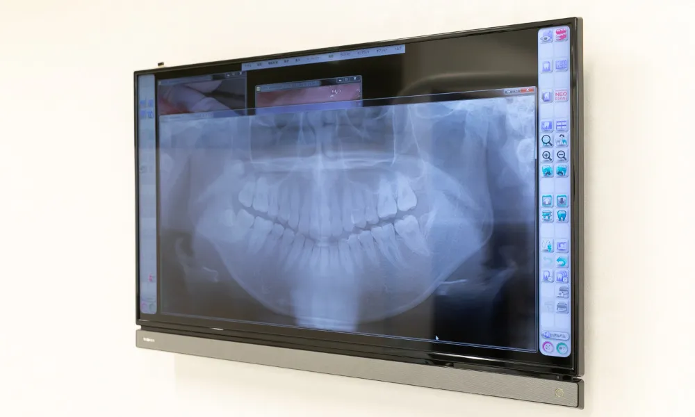 step:2 診査・診断のための精密検査