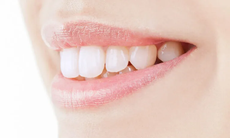 審美治療・ホワイトニング