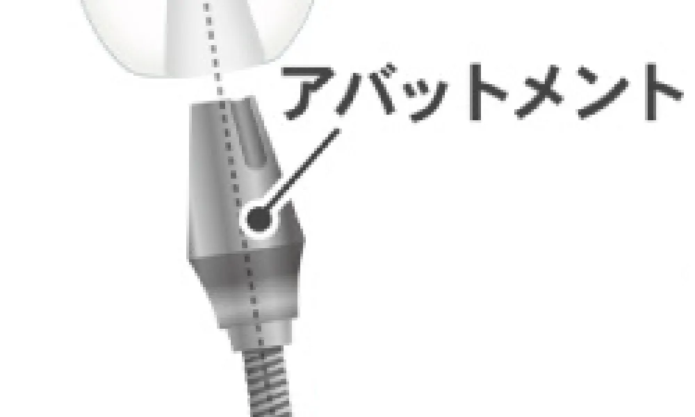 6.アバットメントを装着する