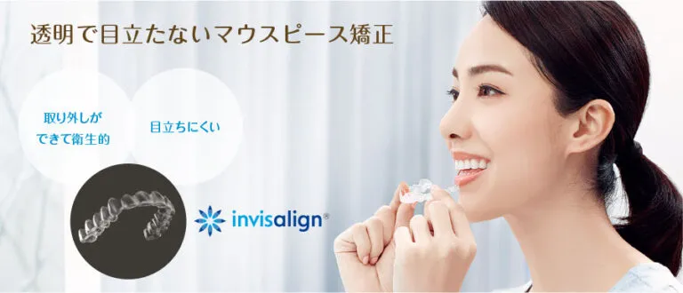 インビザライン